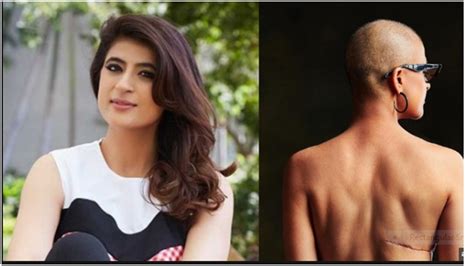 Tahira Kashyap Flaunts Surgery Mark On World Cancer Day The Asian Connections Newspaper
