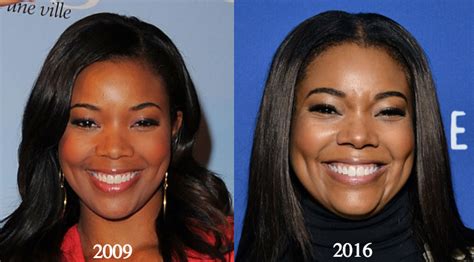 Gabrielle Union Plastic Surgery Rumors Compare Before And After Photos