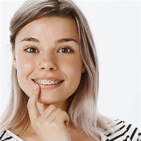 How Long Do You Have To Wear Braces To Fix An Overbite Overbite