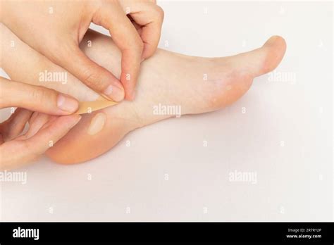 Person Applies Adhesive Plaster On Foot Calluses Skin Corns On Heel