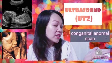 Pinagkaiba Ng Cas And Ultrasound Youtube