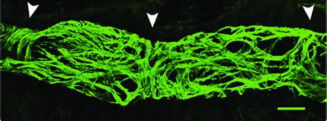 Smooth Muscle Cells Around The Collecting Lymphatic Vessel In The Rat