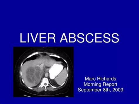 Ppt Liver Abscess Powerpoint Presentation Free Download Id6682952