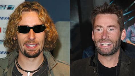 Chad Kroegers Plastic Surgery The 48 Year Old Canadian Singers