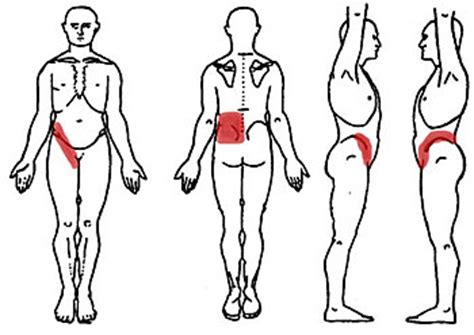 Lower left back pain, or left flank pain, refers to pain in the area above the hip or buttocks. Kidney Disease: The Neglected Fatal Disease - Medi Connect ...