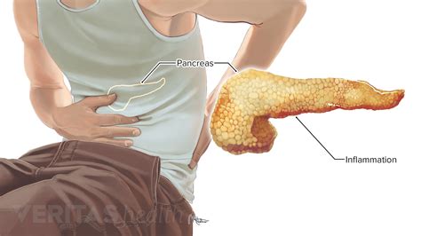 The two kidneys lie on each side of the spine in the lower part of the back. Lower Left Back Pain from Internal Organs
