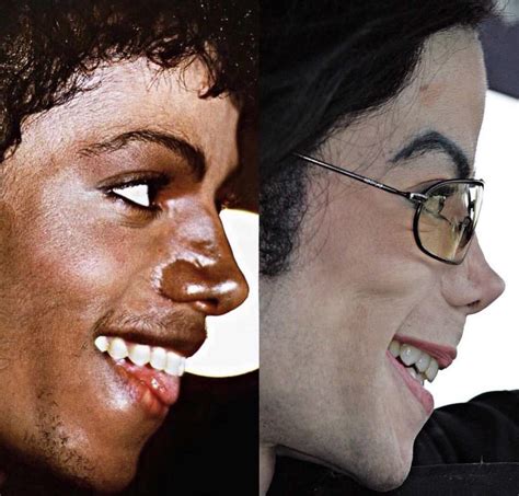 Michael Jackson Comparison 1982 2005 Rmichaeljackson