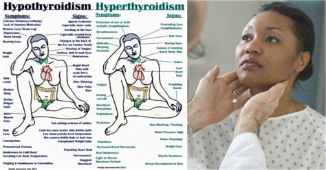 thyroid disorder signs symptoms causes and natural remedies