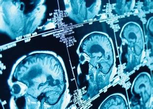 Check spelling or type a new query. Biopsychology A (Introduction) Online Course | Careerline ...