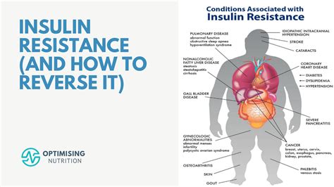 Master Macros For Insulin Resistance For Optimal Health Optimising