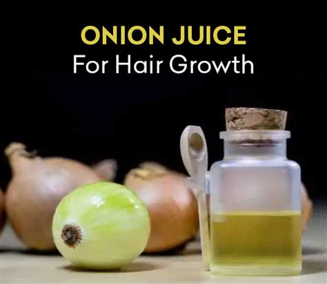 Onion Juice For Hair Growth Benefits And How To Use