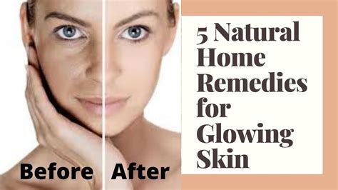 5 Best Natural Remedies For Glowing Skin Youtube