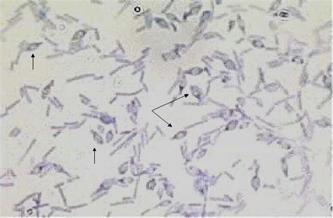 Bacteriology 6 Gram Positive Bacilli Anaerobes