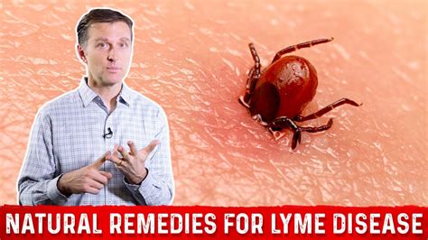 Lyme Disease Natural Remedies And Treatment Dr Berg Youtube