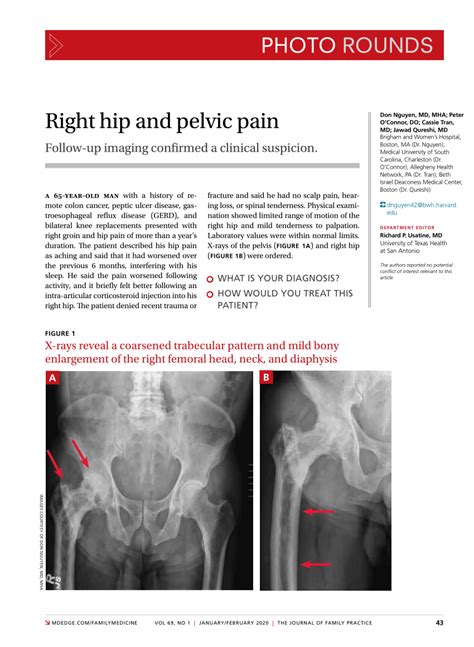 Pdf Photo Rounds Right Hip And Pelvic Pain