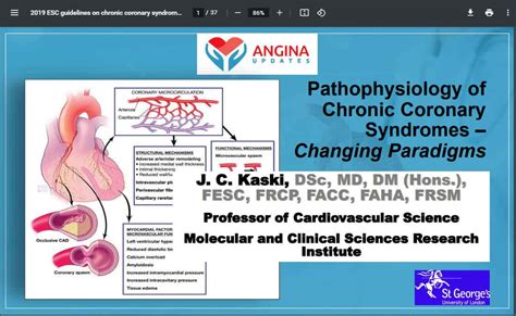 Pathophysiology Of Angina Cv Update