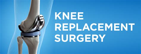 Knee Replacement Surgery Procedure Types And Risks Memon Medical