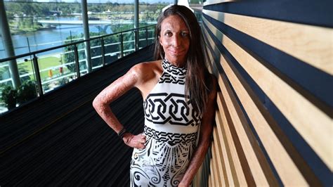Turia Pitt S Recovery Was Paved With A Focus On Small Steps Gratitude And Service Youtube