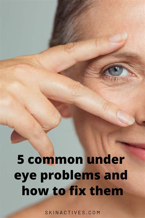 5 Common Under Eye Problems Skin Actives In 2020 Skin Active Eyes