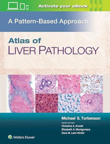 Atlas Of Liver Pathology A Pattern Based Approach By Torbenson
