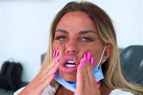 Katie Price Reveals Gruesome Look At Teeth Reconstruction Surgery In