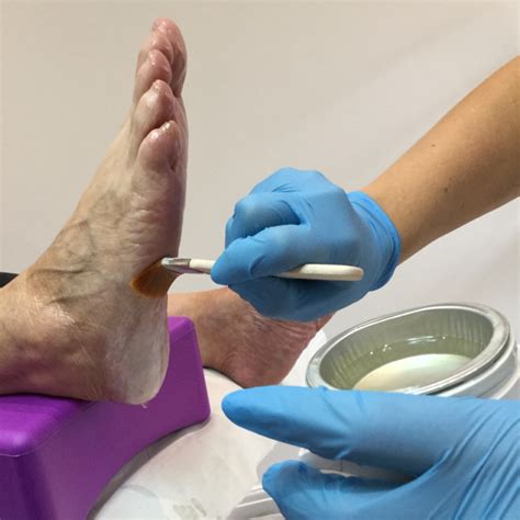 The Benefits Of Paraffin Wax Treatments In Podiatry Care For Feet