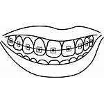 Braces Clipart Creepy Transparent Drawing Tooth Clip