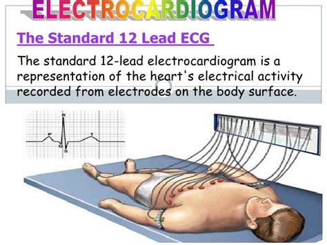 Ecg Updatebasic Cardiology