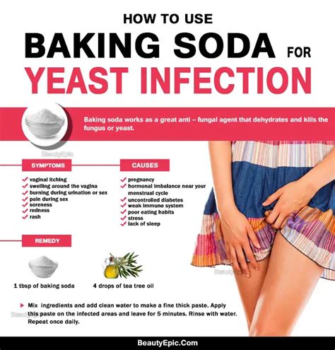 What Is The Fastest Way To Get Rid Of A Yeast Infection Mastery Wiki