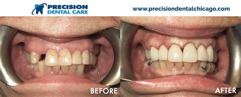 We offer you a range of dental treatments. Precision Dental Care | The Best Dentists in Chicago IL