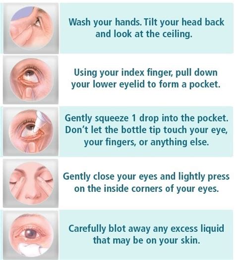 How To Use Eye Drops Properly Stella