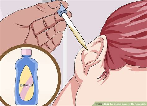 Commercially available ear cleansing solutions treating the ears with hydrogen peroxide to clean dog ears, common household items such as vinegar and hydrogen peroxide can be. 3 Ways to Clean Ears with Peroxide - wikiHow