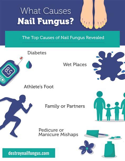 What Causes Nail Fungus The Top 5 Causes Revealed Destroy Nail Fungus