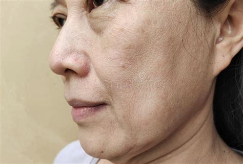 The Wrinkles And Flabby Skin Cellulite And Dark Spots Under The Eyes