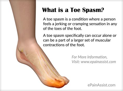 What Causes Toe Spasm Home Remedies And Exercises To Relieve It