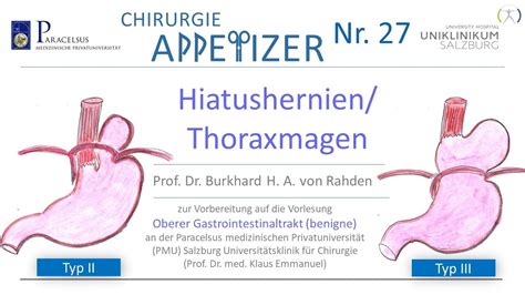 Hiatushernien Thoraxmagen Chirurgie Appetizer Nr27 Youtube