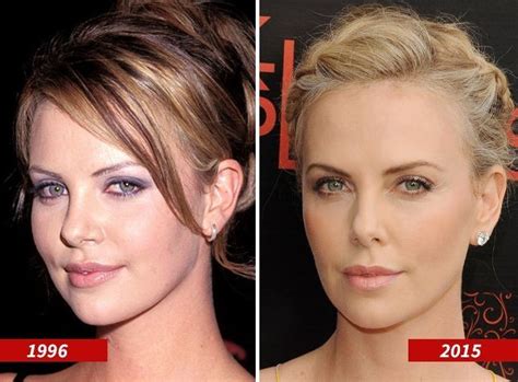 Charlize Theron Before And After Plastic Surgery Celebrity Plastic
