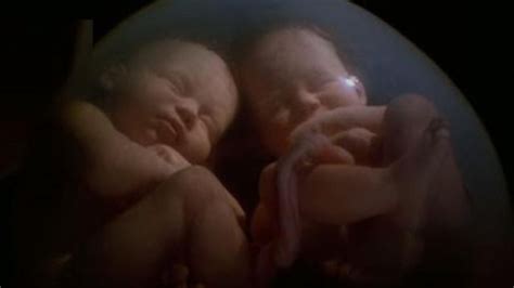 Twin Babies Caught On Mri Scan Fighting In Their Mothers Womb Amazing
