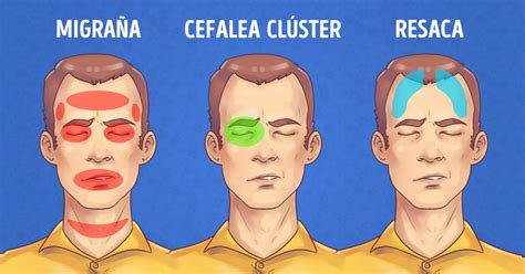 5 tipos de dolor de cabeza y cómo aliviarlos rápidamente