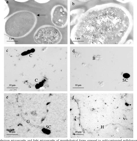 Figure 1 From Which Morphological Forms Of The Fungus Aureobasidium