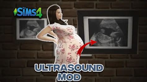 Sims 4 Ultrasound Mod Pregnancy Scan Pictures Littlemssam