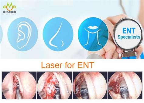 Diode Ent Laser Ear Nose Throat Ent Laser Surgery Therapy 15w 20w 30w