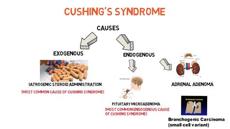 Cushings Syndrome Youtube