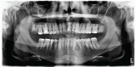 Preoperative Clinical Photograph And Radiographs Showing A