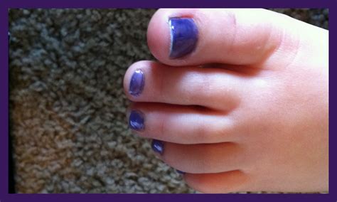 Purple Toes In Honor Of Rett Syndrome Awareness Month Keepin Up