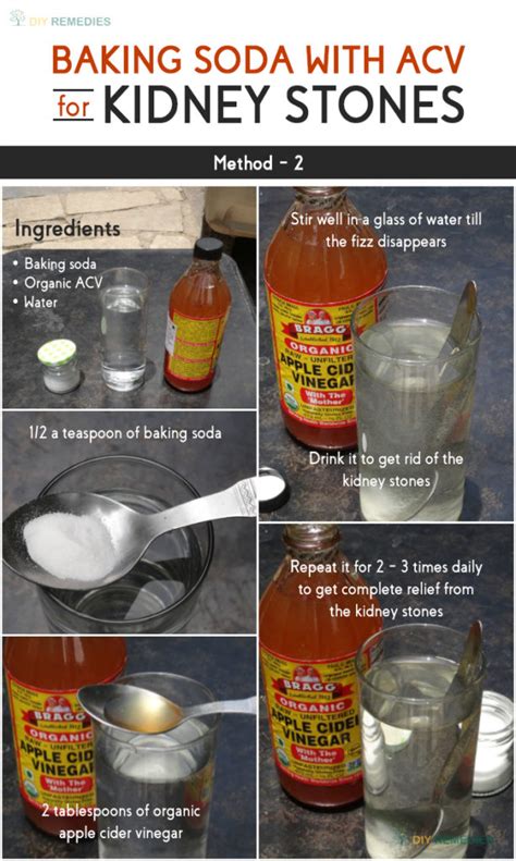 Natural stone surfaces on floors and countertops can become etched from vinegar. How to Get Rid of Kidney Stones using Baking Soda