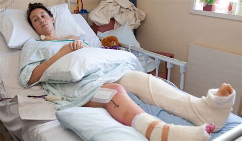Car Puts Army Hopeful In Hospital With Broken Leg Nz