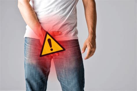 Jock Itch Facts Causes Symptoms Treatment And Prevention Factdr