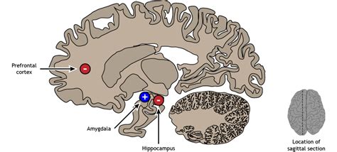 Sagittal View Of The Human Brain Labeled Sagittal Bra