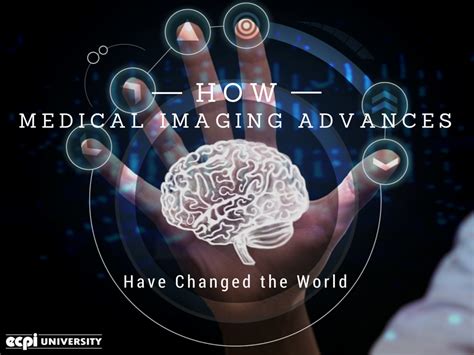 What does an mri technician do? Medical Imaging Advances that Have Changed the World